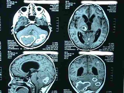 El cuidado de la salud en el Per&uacute; actual